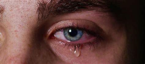 What Causes Watery Eyes and How Can You Treat Them? – Sightsage