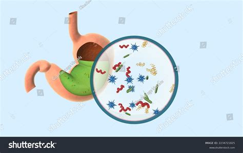 Germs Stomach Cause Stomachache Food Poisoning Stock Illustration 2234721825 Shutterstock