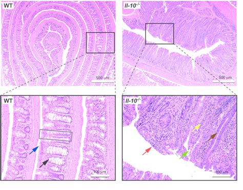 Intestinal Inflammation Creates A Different Environment For The Gut Download Scientific Diagram