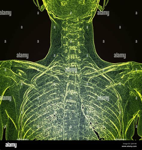 Healthy rib cage, X-ray Stock Photo - Alamy