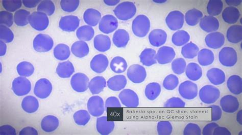 Geimsa Stain For Plasmodium And Babesia Parasite Diagnostics Youtube