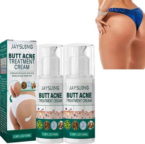 Butt Acne Cream Treatment For Eliminating Butt Pimples Reducing Acne