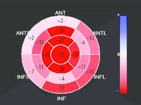 Bull S Eye Display Of Segmental Peak Systolic Longitudinal Strain