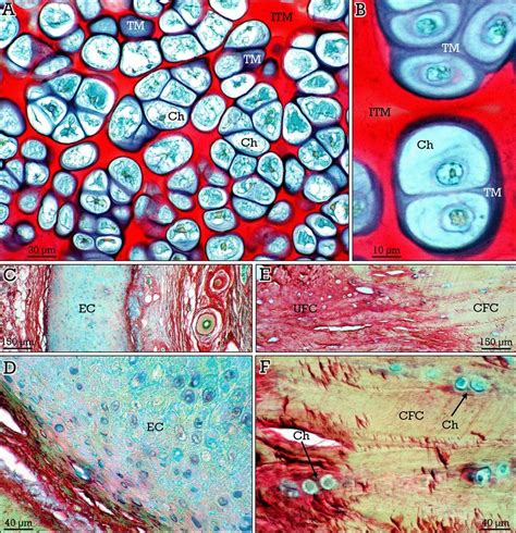 RGB trichrome staining of cartilage. (A,B) Hyaline cartilage shows ...