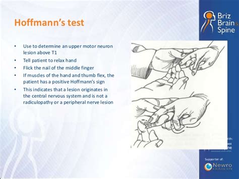 test de hoffman