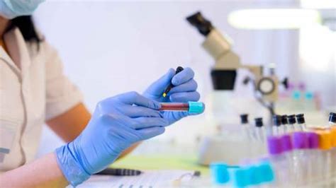 Когда нужно сдать анализы на венерические заболевания?