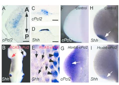 Ectopic Expression Of Chick Pcl2 Suppresses Shh Expression In The Zpa