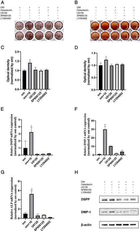 Osteolectin Promotes Odontoblastic Differentiation In Human Dental Pulp