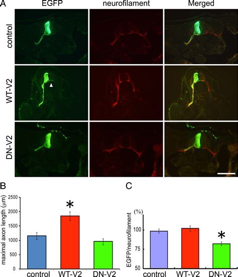 Trpv2 Enhances Axon Outgrowth Through Its Activation By Membrane