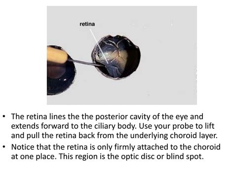 Ppt Sheep Eye Dissection Powerpoint Presentation Free Download Id