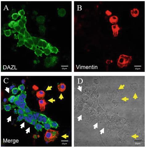 Undifferentiated And Differentiated Spermatogonial Stem Cells Intechopen