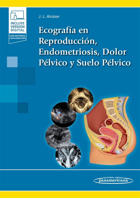 Ecograf A En Reproducci N Endometriosis Dolor P Lvico Y Suelo P Lvico