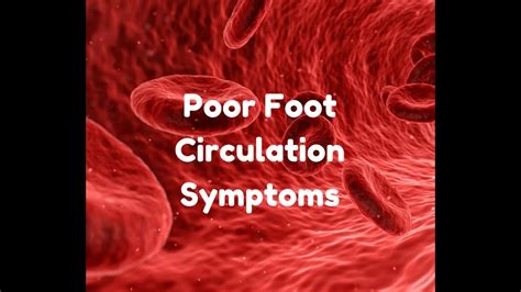 Poor Foot Circulation Symptoms Youtube