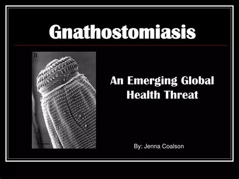 PPT - Gnathostomiasis PowerPoint Presentation, free download - ID:558540