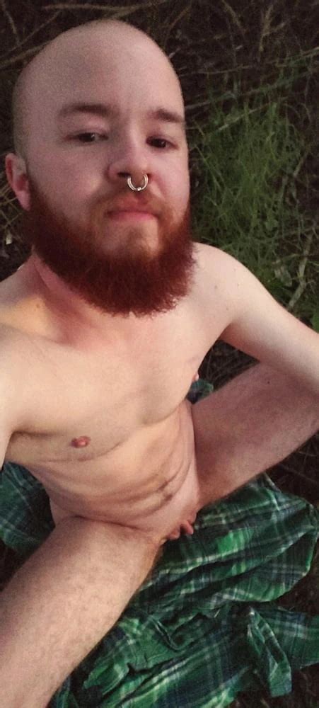 Man With Pussy FTM 23 Pics XHamster