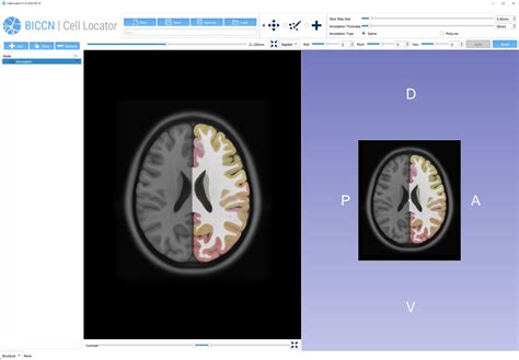 Mni Annotation Needs To Be Double Sided Issue Biccn Cell