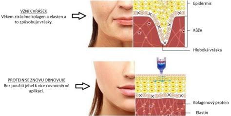 Hyaluron Pen – Kosmetický salon DianaKa