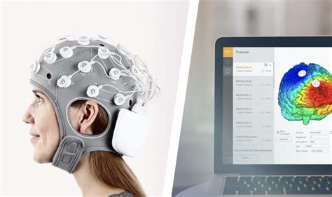 Neuroelectrics Archivos Med Rent