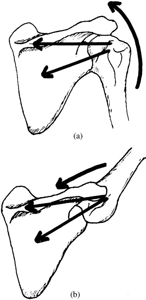 Ða Forces Of The Rotator Cu Provide Compression And Depression To