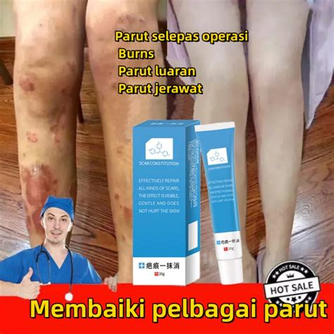 Krim Parut Hilangkan Parut Hitam Scar Removal Cream Remove Stretch