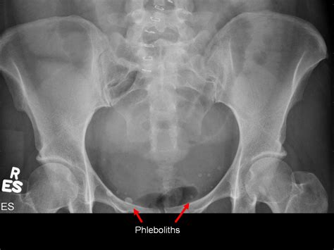 On Call Radiology - common radiology findings on call and in the ...