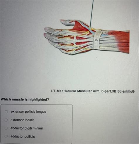 Solved Copyright Som Which Muscle Is Highlighted Dorsal Chegg