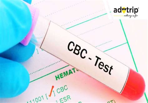 CBC Test Cost In India CBC Complete Blood Count Test Price In India