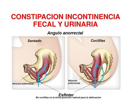 Constipación Incontinencia Fecal Y Urinaria Maryuri Lisbeth Udocz