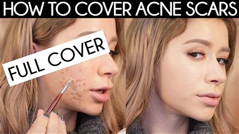 How To Cover Acne Scars How To Cover Acne With Makeup Youtube