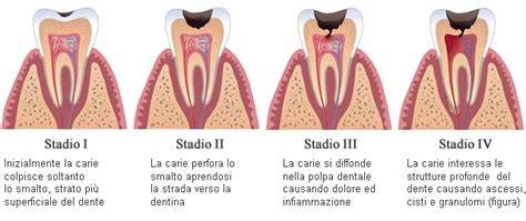 Gennaio Studio Dentistico Arioli