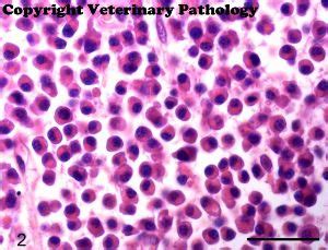 Plasma Cells Histology