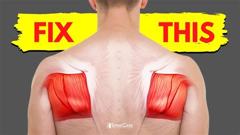 How To Fix Shoulder Blade Pain For Good Youtube