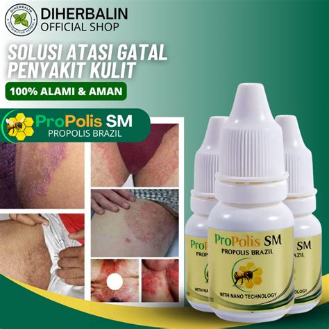 Jual Obat Salep Gatal Selangkangan Eksim Infeksi Jamur Kurap Kudis