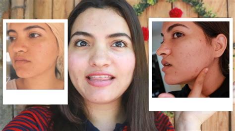 Colageno Renova Antes E Depois - 7 DÍAS TOMANDO COLAGENO + BEFORE & AFTER - YouTube