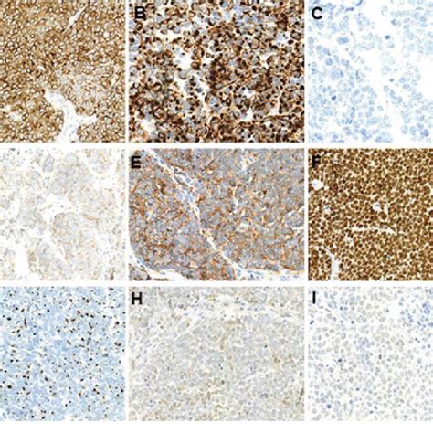 Morphology And Localization Of Merkel Cells A Location Of Merkel Cells