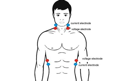 Electrode Placement For Tetrapolar Impedance Cardiography Measurement