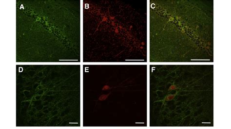 Dor Egfp Mainly Colocalizes With Parvalbumin Immunoreactivity In The