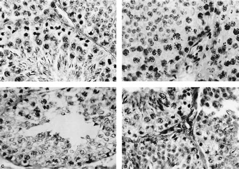 A Histoarchitecture Of Pretreatment Testis Showing All Stages Of