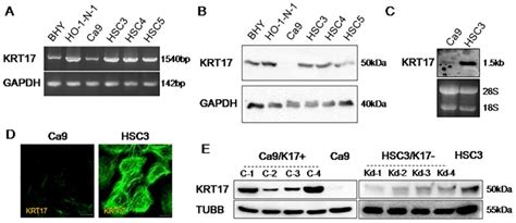 keratin   induced  oral cancer  facilitates tumor growth pmc