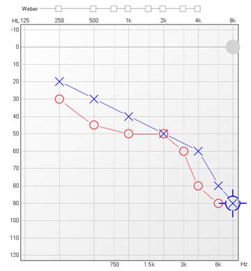 How is an audiogram read? | Connect Hearing