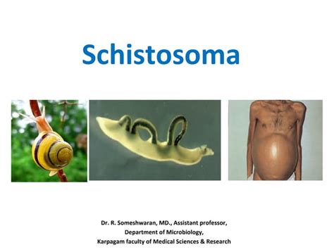 Schistosoma Ppt Dr Somesh 2015 Parasitology Trematodes Ppt