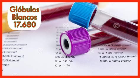 Valores Normales De Hemograma An Lisis De Sangre Youtube