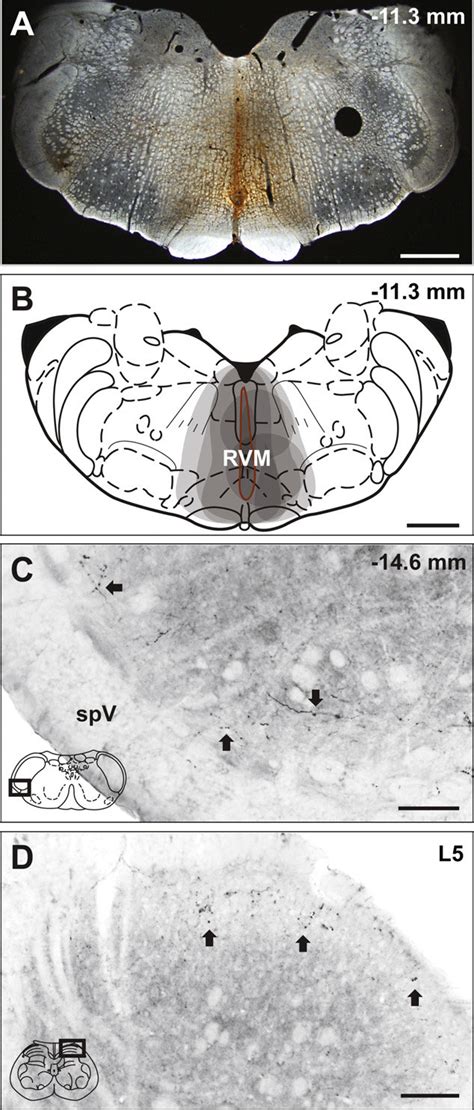 Bda Injections Into Rvm Produce Anterograde Labeling In Trigeminal And