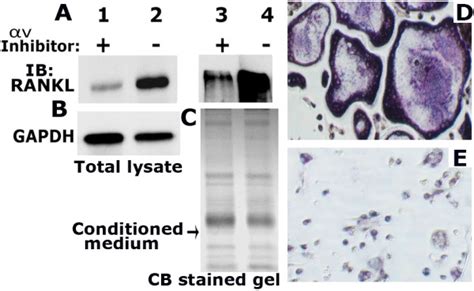 The effect of integrin αv inhibitor on RANKL expression and osteoclast