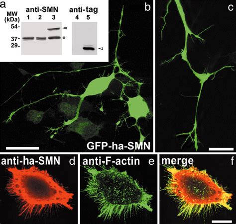 Axonal Smn A Smn A Protein Isoform Of The Survival Motor Neuron Gene