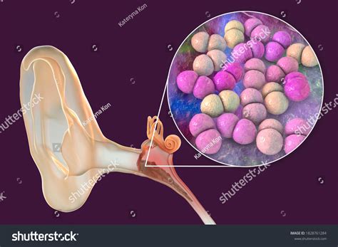 53 Fluid The Ear Kid Images, Stock Photos & Vectors | Shutterstock