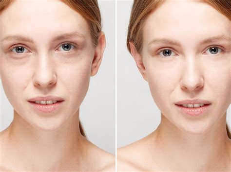 Buscas Algo Natural Y Efectivo Para Eliminar Las Ojeras Este Suero