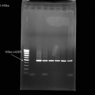 Agarose Gel Electrophoresis Stained With Ethidium Bromide Of Its