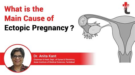 What is the main cause of Ectopic Pregnancy in Hindi असथनक