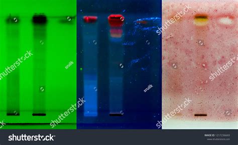 Thin Layer Chromatography Bioautography Assay Comparison Stock Photo